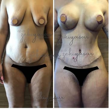 Slider image (10) Dr. Zeki Yasar Clinic